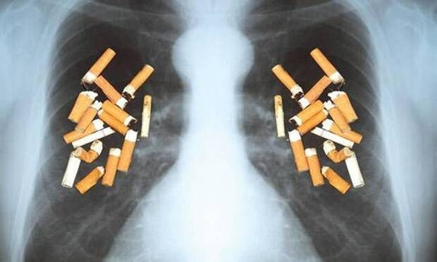 Bugün, 9 Şubat Dünya Sigara Bırakma Günü