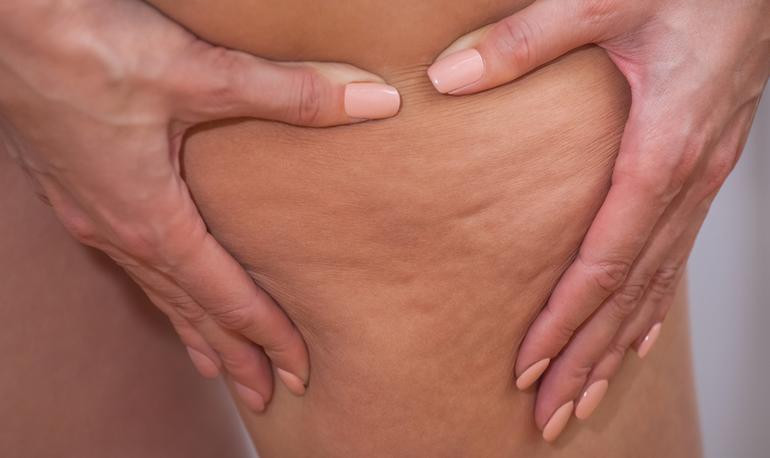 Vücut yağına dair 4 yaygın yanlış bilgi