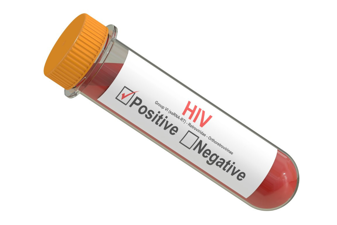 Bugün 1 Aralık Dünya AIDS Günü