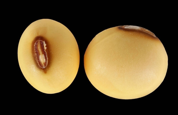 Bilimsel olarak kanıtlandı Bu besinler kanserin düşmanı