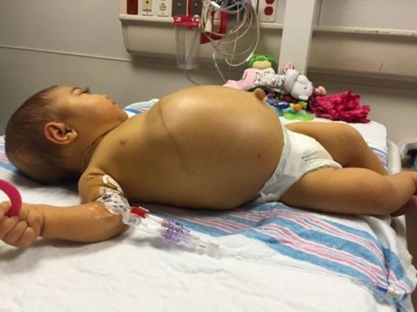 Karnı şişmeye başladı, ailesi gerçeği sonradan öğrendi