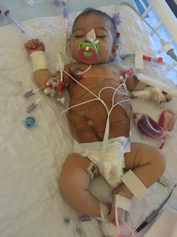 Karnı şişmeye başladı, ailesi gerçeği sonradan öğrendi