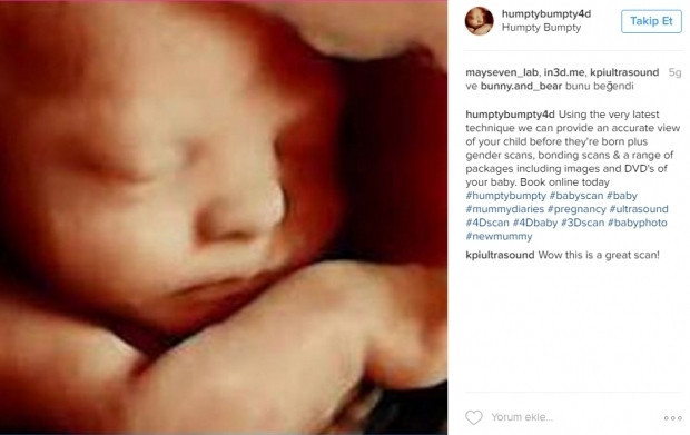 Bebeklerinin ultrason görüntülerini Instagramdan paylaşan anne adayları