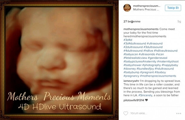 Bebeklerinin ultrason görüntülerini Instagramdan paylaşan anne adayları
