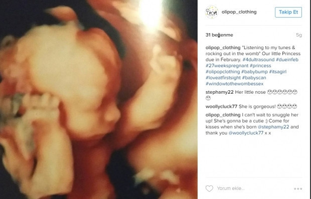 Bebeklerinin ultrason görüntülerini Instagramdan paylaşan anne adayları
