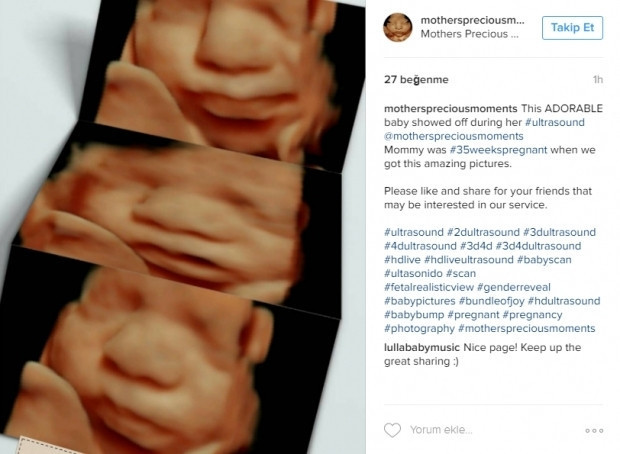 Bebeklerinin ultrason görüntülerini Instagramdan paylaşan anne adayları