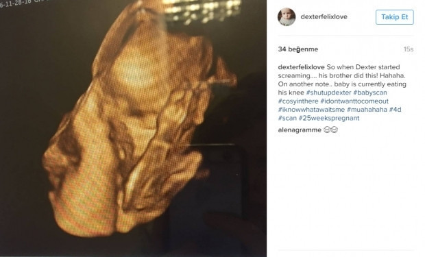 Bebeklerinin ultrason görüntülerini Instagramdan paylaşan anne adayları