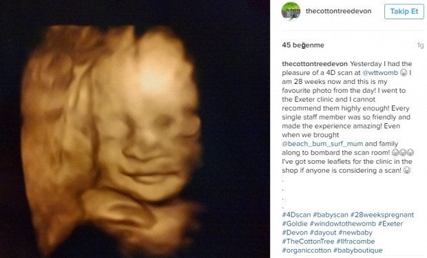 Bebeklerinin ultrason görüntülerini Instagramdan paylaşan anne adayları