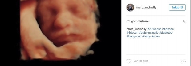 Bebeklerinin ultrason görüntülerini Instagramdan paylaşan anne adayları