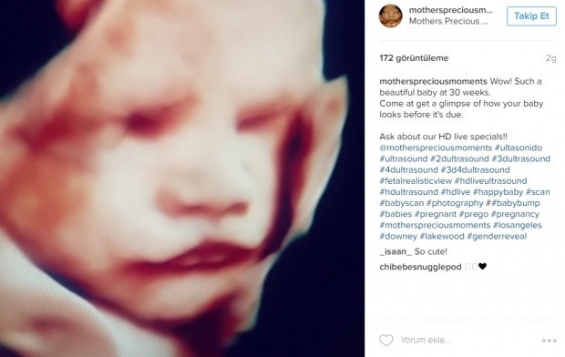 Bebeklerinin ultrason görüntülerini Instagramdan paylaşan anne adayları