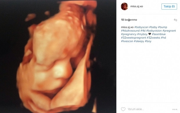 Bebeklerinin ultrason görüntülerini Instagramdan paylaşan anne adayları