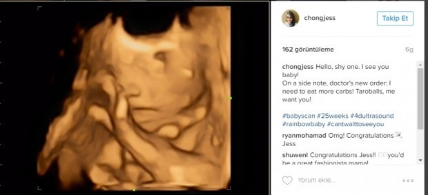 Bebeklerinin ultrason görüntülerini Instagramdan paylaşan anne adayları