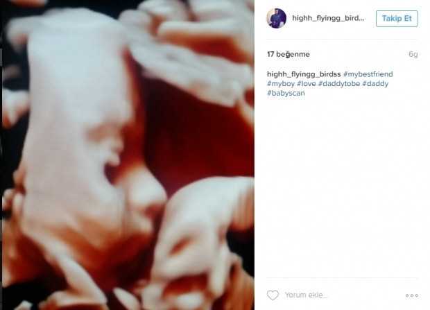 Bebeklerinin ultrason görüntülerini Instagramdan paylaşan anne adayları