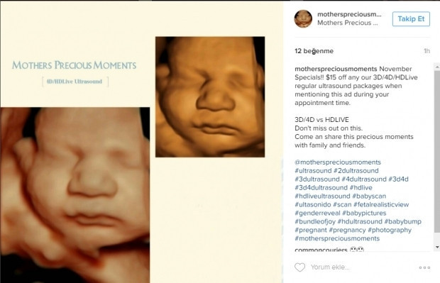 Bebeklerinin ultrason görüntülerini Instagramdan paylaşan anne adayları