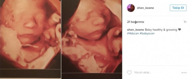 Bebeklerinin ultrason görüntülerini Instagramdan paylaşan anne adayları