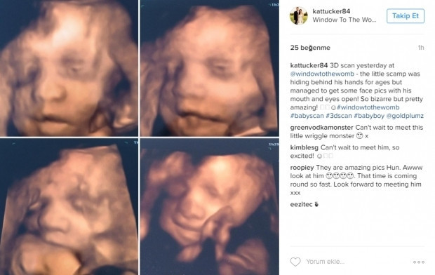 Bebeklerinin ultrason görüntülerini Instagramdan paylaşan anne adayları