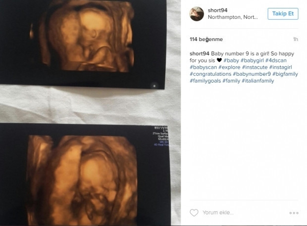 Bebeklerinin ultrason görüntülerini Instagramdan paylaşan anne adayları