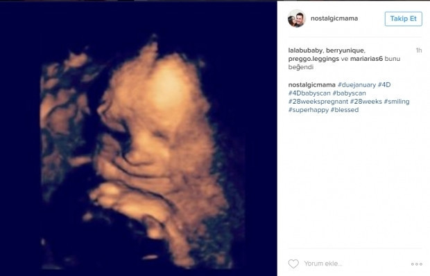 Bebeklerinin ultrason görüntülerini Instagramdan paylaşan anne adayları