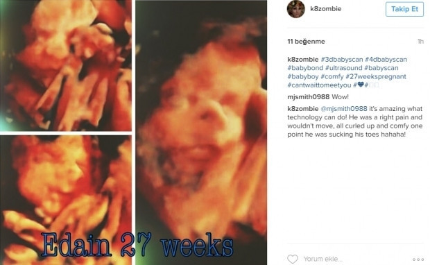 Bebeklerinin ultrason görüntülerini Instagramdan paylaşan anne adayları