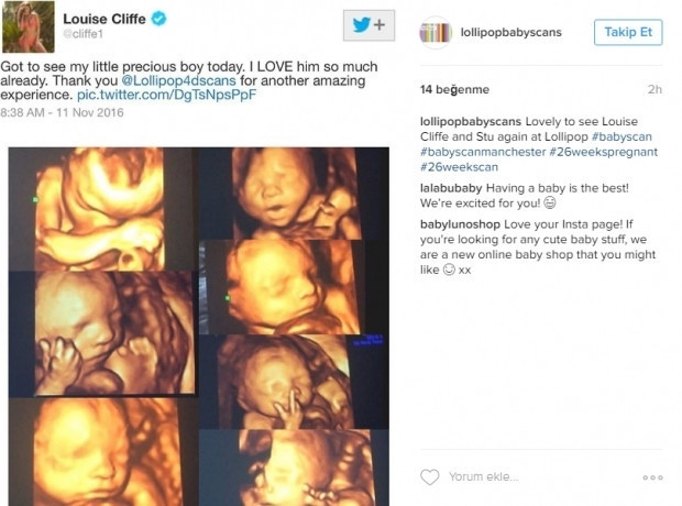 Bebeklerinin ultrason görüntülerini Instagramdan paylaşan anne adayları