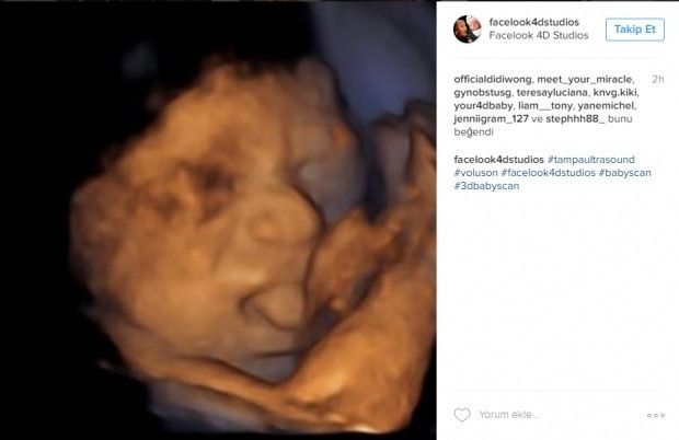 Bebeklerinin ultrason görüntülerini Instagramdan paylaşan anne adayları
