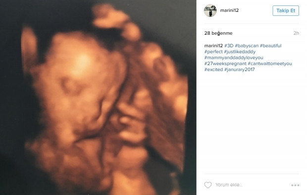 Bebeklerinin ultrason görüntülerini Instagramdan paylaşan anne adayları
