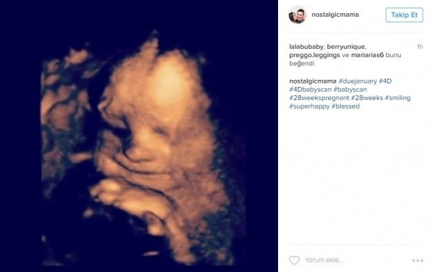 Bebeklerinin ultrason görüntülerini Instagramdan paylaşan anne adayları