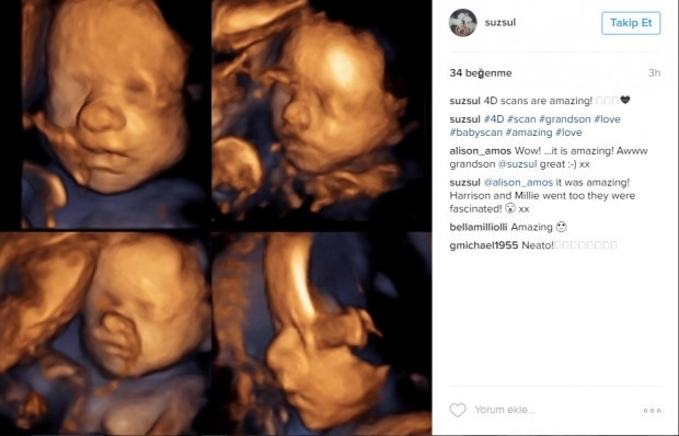 Bebeklerinin ultrason görüntülerini Instagramdan paylaşan anne adayları