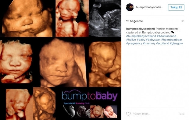 Bebeklerinin ultrason görüntülerini Instagramdan paylaşan anne adayları