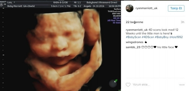 Bebeklerinin ultrason görüntülerini Instagramdan paylaşan anne adayları
