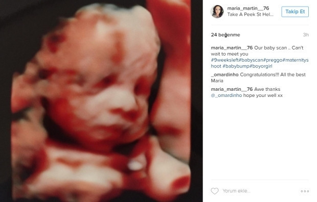 Bebeklerinin ultrason görüntülerini Instagramdan paylaşan anne adayları