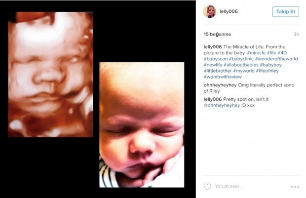 Bebeklerinin ultrason görüntülerini Instagramdan paylaşan anne adayları