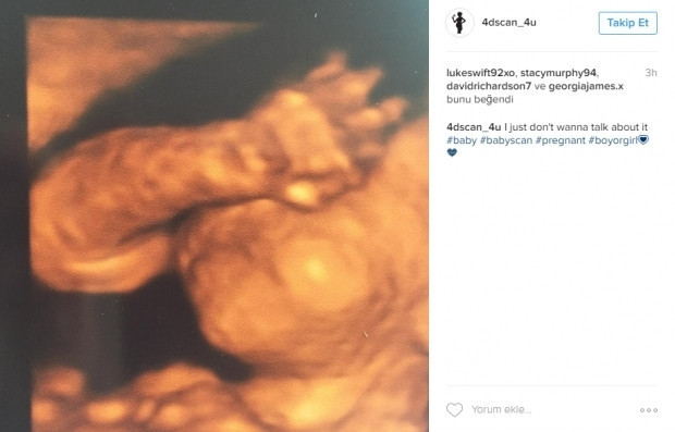 Bebeklerinin ultrason görüntülerini Instagramdan paylaşan anne adayları