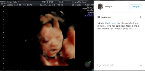 Bebeklerinin ultrason görüntülerini Instagramdan paylaşan anne adayları