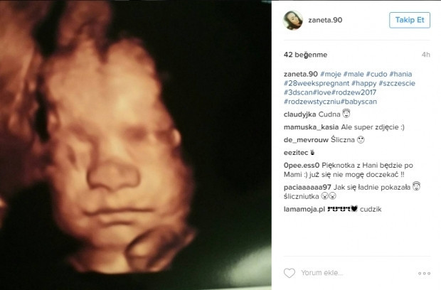 Bebeklerinin ultrason görüntülerini Instagramdan paylaşan anne adayları