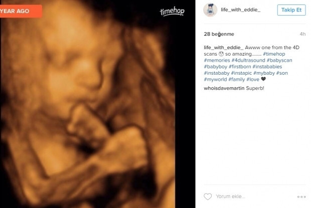 Bebeklerinin ultrason görüntülerini Instagramdan paylaşan anne adayları