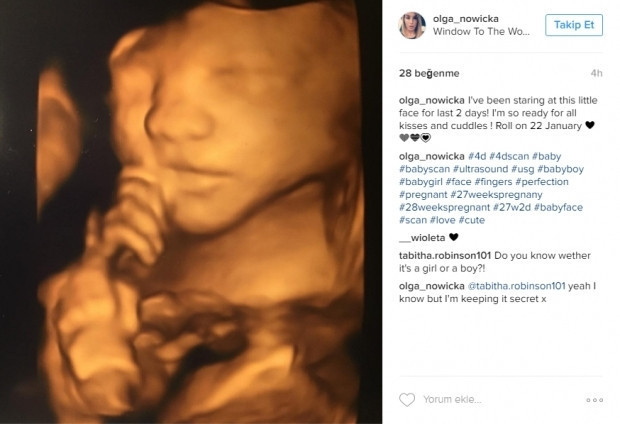 Bebeklerinin ultrason görüntülerini Instagramdan paylaşan anne adayları