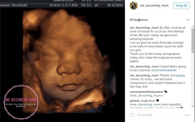 Bebeklerinin ultrason görüntülerini Instagramdan paylaşan anne adayları