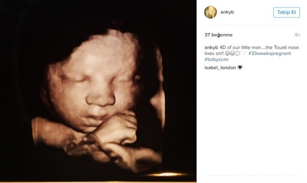 Bebeklerinin ultrason görüntülerini Instagramdan paylaşan anne adayları
