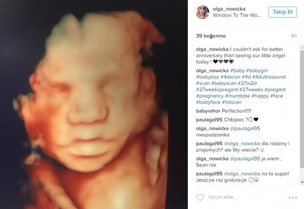 Bebeklerinin ultrason görüntülerini Instagramdan paylaşan anne adayları