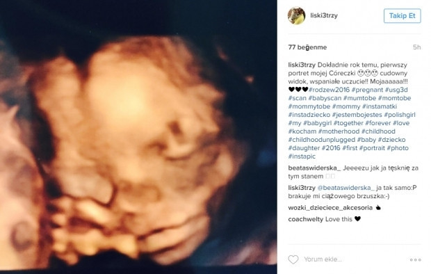 Bebeklerinin ultrason görüntülerini Instagramdan paylaşan anne adayları