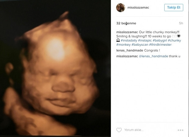 Bebeklerinin ultrason görüntülerini Instagramdan paylaşan anne adayları