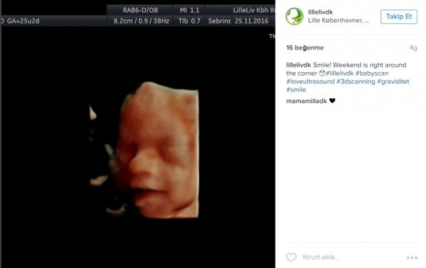 Bebeklerinin ultrason görüntülerini Instagramdan paylaşan anne adayları