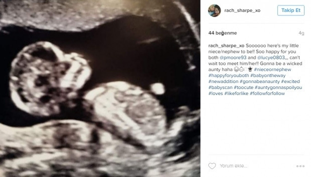 Bebeklerinin ultrason görüntülerini Instagramdan paylaşan anne adayları