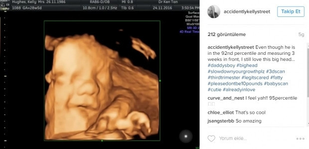 Bebeklerinin ultrason görüntülerini Instagramdan paylaşan anne adayları