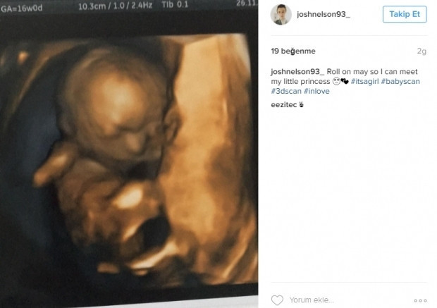 Bebeklerinin ultrason görüntülerini Instagramdan paylaşan anne adayları