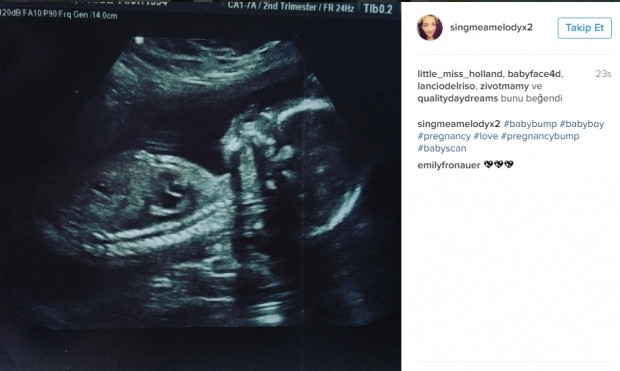 Bebeklerinin ultrason görüntülerini Instagramdan paylaşan anne adayları