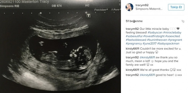 Bebeklerinin ultrason görüntülerini Instagramdan paylaşan anne adayları