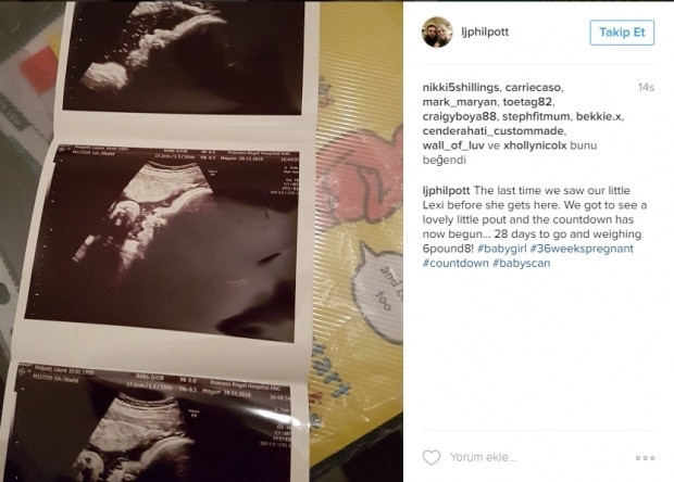 Bebeklerinin ultrason görüntülerini Instagramdan paylaşan anne adayları