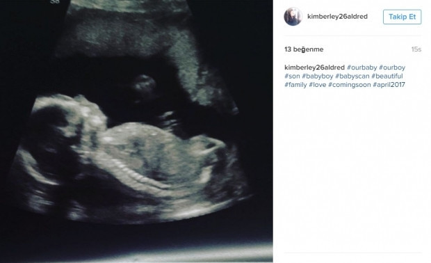 Bebeklerinin ultrason görüntülerini Instagramdan paylaşan anne adayları